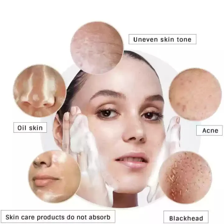 Dermatologist%20Tested%20Best%20Selling%20Foaming%20Face%20Wash%20For%20Clear%20Skin%20-%20Suitable%20for%20All%20Skin%20Types%20100%20ml%20%20-%20This%20Will%20Change%20Your%20Life:%20Say%20Hello%20to%20Glow%20with%20Our%20Best%20Selling%20Face%20Wash!%20%E2%98%85%E2%98%85%E2%98%85%E2%98%85%E2%98%85%20-%20Image%203