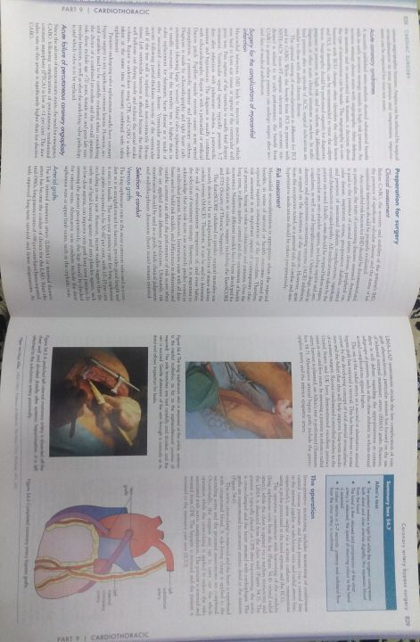 Bailey%20&%20Love%20Short%20Practice%20of%20Surgery%2026th%20edition%20-%20Image%204