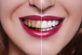 100% Natural Herbal Homeo Tooth Powder (Teeth Manjan) Dental Remedy Teeth Whitening No Side Effect. 