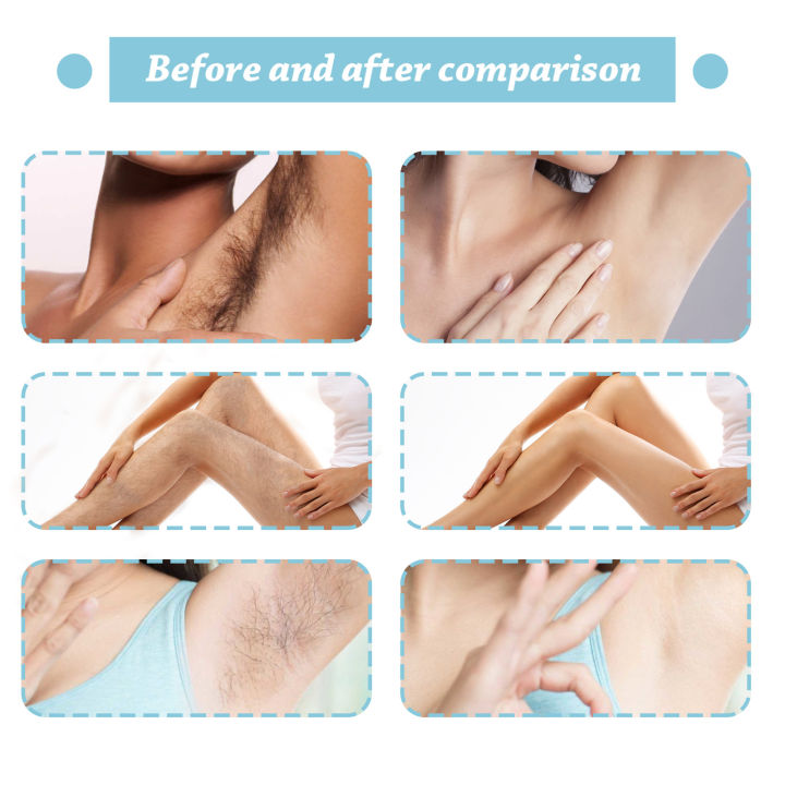 West%20&%20Month%20Women%20Hair%20Removal%20Spray%20Armpit%20Body%20Quick%20Hair%20Removal%20Private%20Part%20Gentle%20Quick%20Hair%20Removal%20No%20Stimulation%20-%20Image%206