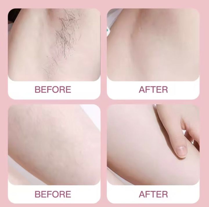 Original%20MAX%20Lady%20Razor%205%20piece%20Bikini%20Razor%20Woman%20Razor%20Shaver%20Safety%20Female%20Hair%20Removal%20Double%20Blades%20Hair%20Razor%20Machine%20Mini%20Shaving%20Razor%20-%20Image%202