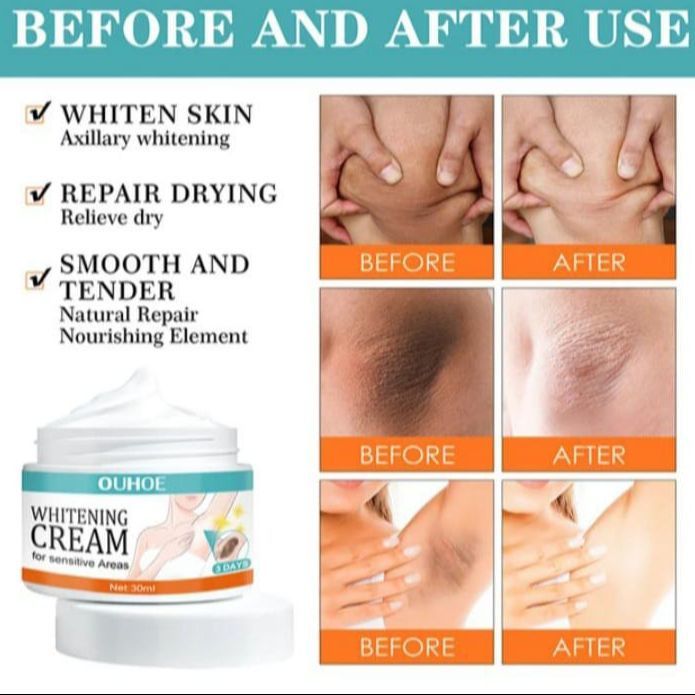 %E2%80%9CWhitening%20cream%20for%20sensitive%20skin,%20underarm%20and%20body%20brightening%20-%20Image%202