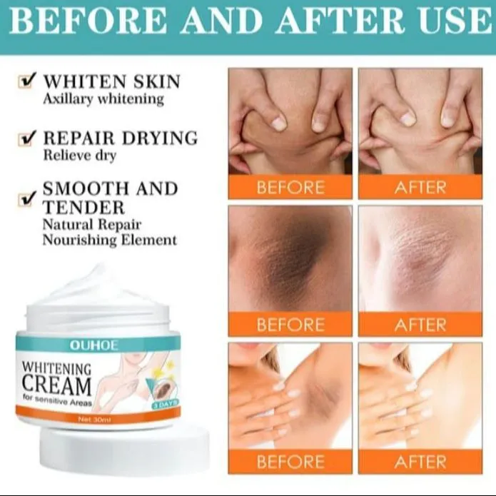 %E2%80%9CWhitening%20cream%20for%20sensitive%20skin,%20underarm%20and%20body%20brightening%20-%20Image%202