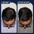 phone case FEG Organic Anti Hair Loss Hair Growth Treatment Oil For Thicker Long Hair  50ML. 