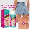 Hip Acne Treatment Cream Butt Inner Thigh Pimples Clearing Remove Dark Spot Prevent Buttock Pores Clogging Body Acne Repair Care. 
