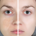 Metafil moisturising Cream | 50g. 