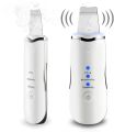 Facial Skin Scrubber Face Spatula, Ultrasonic Skin Spatula Scrubber Blackhead Remover Gentle Peel Peeling Pore Cleanser Exfoliator Lifting Tool Comedones Extractor USB Rechargeable. 