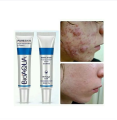 Bio aqua Acne Cream Face Skin Care Acne Anti-Wrinkle Removal Cream Spots Scar Blemish Marks 30g. 