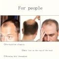 Men's Invisible Hair Topper - Short Straight Synthetic Fiber, Natural Look for Thinning & Balding Coverage, High-Temperature Resistant, Fit, Invisible Wig, Synthetic Fiber, Balding Coverage. 