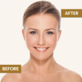Face Fresh Gold Plus Beauty Cream (230gm). 