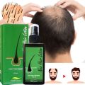 Neo Hair Lotion For Hair Growth Green Wealth. 