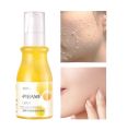Pibamy Exfoliating Gel Facial Moisturizing Refreshing Skin. 