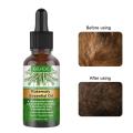 30ml Hair Oil Convenient Long Lasting Lightweight Rosemary Hair Essential Oil for Home Hair Loss Product Series. 