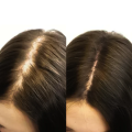Foliboost Hair Serum | 45ml. 