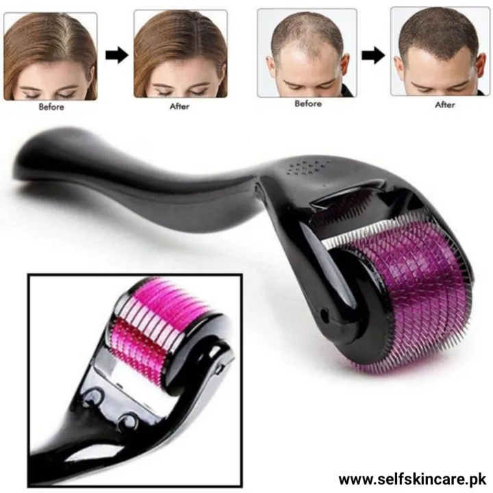Derma%20Roller%201mm%20with%20540%20Micro%20Needles%20-%20Derma%20Roller%20for%20Skin%20-%20Derma%20Roller%20for%20Hair%20-%20Derma%20Roller%20for%20Face%20-%20Derma%20Roller%20for%20Hair%20Growth%20-%20Image%205