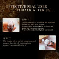 OEDO Ginseng Hair Growth Essence Preventing Hair Loss Liquid Damage Hair Repair Treatment Dense Fast Restoration Hair Growth 20ml. 