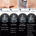 Acne Pimple 4 in 1 Pore Cleaner Vacuum Suction Tool Blackhead Removal On Nose Sucking Machine Blackheads Removal Device Derma Suction - Rechargeable  Shopikbuzz pk| Ecartmax. 