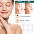 Acne Warts Removal Patch Skin Cleaning Tags Pimple Treatments Corn Plaster Acne Warts Invisible Healing Antibacterial Stickers. 
