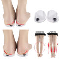 1 Pair Correction Shoe Heel Pads Silicone O/X Type Leg Bowed Legs Knee Valgum Straightening Support Magnetic Therapy Insoles. 