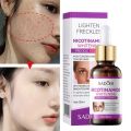 SADOER Nicotinamide Serum 30ml for Dark Spots, Freckles & Uneven Skin Tone - Brightening. 