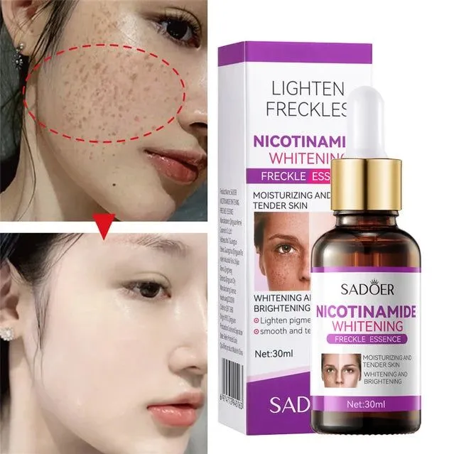 SADOER%20Nicotinamide%20Serum%2030ml%20for%20Dark%20Spots,%20Freckles%20&%20Uneven%20Skin%20Tone%20-%20Brightening%20-%20Image%202