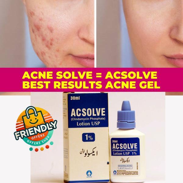 AcSolve Acne Gel Fast-Acting, Dermatologist-Approved Clindamycin Phosphate 1% Gel for Clearer Skin!