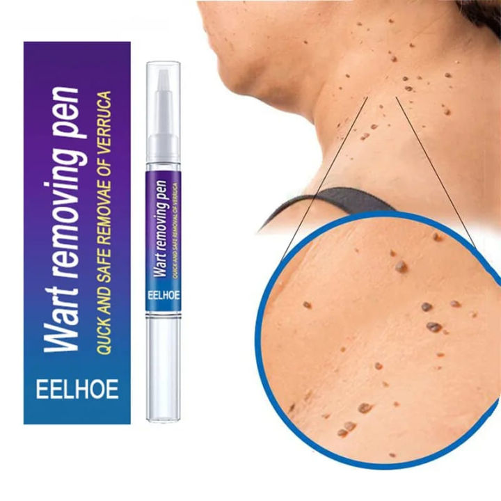Skin Tag eye Wart Mole Remover Pen Woman Skin Care Removing Against Moles Pimple Patch Remove Black Dot FLAIREX