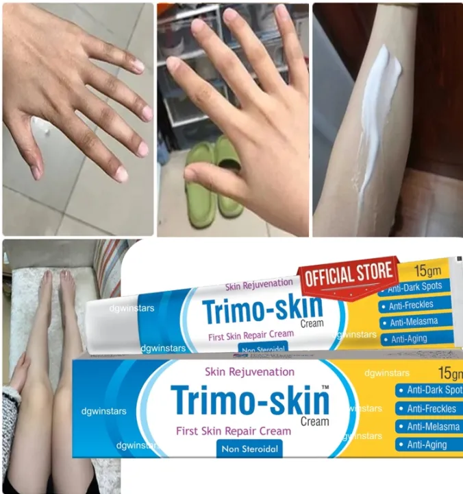 Trimo%20Skin%20Cream%20for%20Face,%20Hands%20&%20Feet%20Scar%20Dark%20Spot%20Removal,%20For%20Acne%20and%20Pigmentation%20Treatment%20with%20Kojic%20Acid.%20Skin%20Rejuvenation%20and%20Glowing%20Skin%20Care%20for%20All%20Skin%20Types.%20Night%20Cream%20for%20both%20Girls%20&%20Boys%20%7C%20All%20in%20one%20Treatment%20cream%20-%20Image%202
