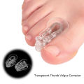 Toe Splitter Thumb Valgus Corrector Big Foot Bone Orthosis Clip Toe Pad Toe Over Yao Store. 