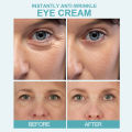 EELHOE Instant Anti-Wrinkle Eye Cream Deep conditioning, lightens fine lines, dark circles, and moisturizing eye cream. 