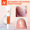MeiYanQiong Herbal Nail Treatment Onychomycosis Paronychia Anti Fungal Nail Infection Good Result Chinese Herbal Toe Nail Fungus Treatment. 