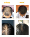120Ml  Hair Care Hair Growth Oil Original Authentic 100% Herbal Hair Loss Liquid Health Care Beauty Dense Hair Growth Serum. 