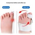 1Piece Big Toe Straightener For Children Bunion Splint Corrector Foot Pain Relief Hallux Valgus Orthopedic Supplies Care Tools. 