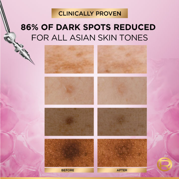 NEW%20L%E2%80%99Or%C3%A9al%20Paris%20Glycolic%20Bright%20Melasyl%C2%A015ml:%20Anti%20Dark%20Spot%20Serum%20-%20Image%208