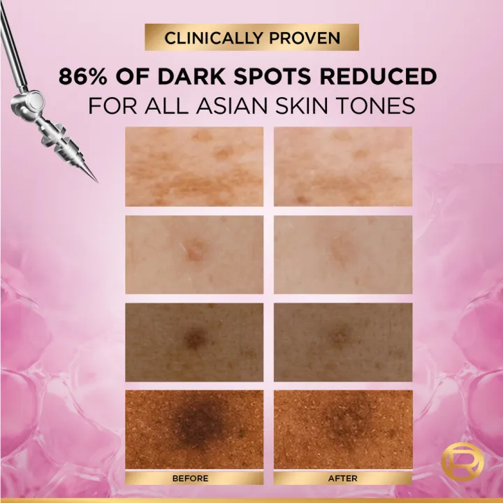 L'oreal%20Paris%20Glycolic%20Bright%20Melasyl%2030ml:%20Anti%20Dark%20Spot%20Serum%20-%20Image%208
