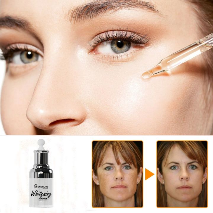 Generous%20Skin%20Care%20Whitening%20Face%20Serum%20For%20Girl%20&%20Women%20For%20All%20Skin%20Types%20-%20Image%207