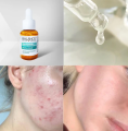 Balance Niacinamide Blemish Recovery Serum -30ml. 
