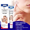 SOL LORA Cross-Border Amazon AliExpress Wart-Removing Cream Wart-Removing Flat Wart-Removing Silk Wart Cream Corns Mole Remover Cream. 