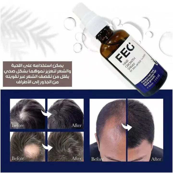 FEG%20Plus%20Hair%20Growth%20Spray%20%E2%80%93%2050ml%20%7C%20Hair%20Fall%20Solution%20for%20Men%20&%20Women%20%7C%20Minoxidil%205%25,%20Biotin,%20Seaweed%20Extract%20%7C%20Regrowth%20%E2%80%93%20100%25%20Genuine%20-%20Image%203
