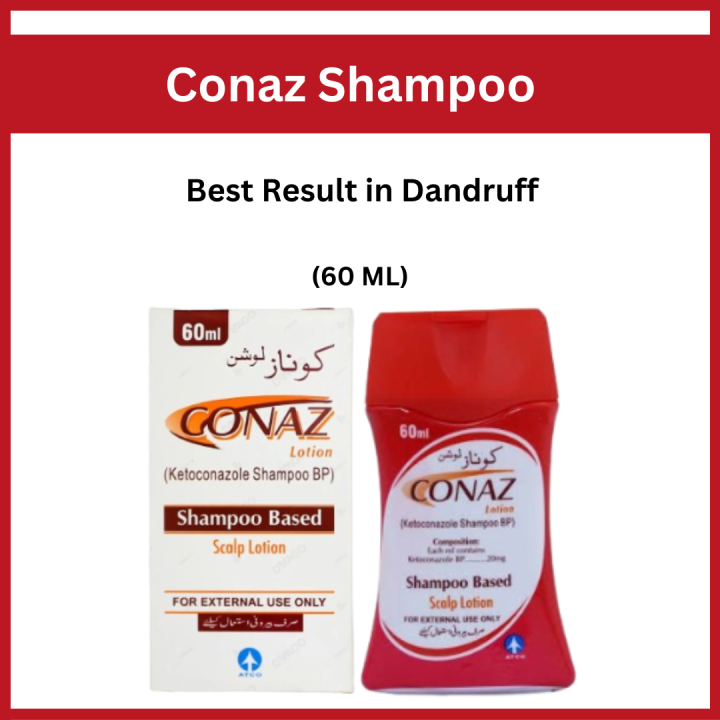 Conaz Ketoconazole Shampoo Best For Dandruff and Fungal Infection in Kids and Adul ts