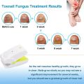 Nail Cleaning Laser Device Professional Safe, Quick and Painless Nail Fungus Treatment For Toe And Finger Nails To Use At-Home No Side Effects. 