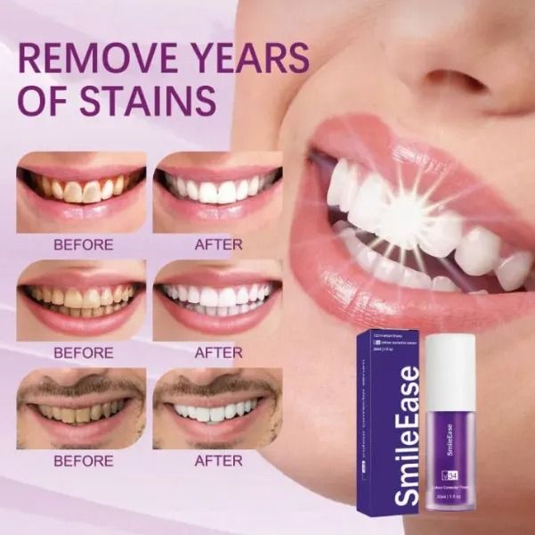 HISMILE%20V34%20Purple%20Orthopedic%20Toothpaste%20,%20Deep%20Stain%20Remover%20,%20Instant%20Teeth%20Whitening%20serum%20,%20Natural%20Teeth%20Whitening,%20Teeth%20Polish%20,%20Teeth%20Stain%20Remover%20,%20Alternative%20to%20Toothpaste%20,%20Tooth%20serum%20for%20Sensitive%20Teeth%20&%20Freshens%20Breath%20-%20Image%205