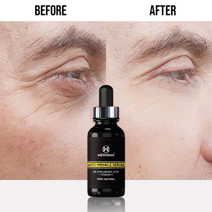 MENIGMA%20Anti%20Wrinkle%20Face%20Serum%20%7C%202%25%20Hyaluronic%20Acid%20With%20Vitamin%20B5%20%7C%20Anti%20Aging%20&%20Hydrating%20Face%20Serum%20%7C%20Fine%20Lines%20&%20Wrinkles%20Care%20%7C%2010ml%20Roll-On%20-%20Image%202