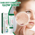 Dark Spot Correcting Glow Serum Fade Pigment Freckle Melasma Melanin Improves Dull Skin Facial Whitening Brightening Essence Moonlight. 