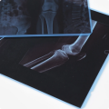 Wholesale X-ray Film blue simco 100 sheets per pack  size 10X12. 