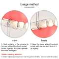Orthodontic Invisible Brace Removal Tool Removable Plastic Hook Aligner Retainer Oral Care Dentistry Ortho Tools. 