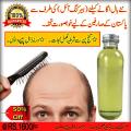 (200% Result) - Hair King Oil - Hair Growing Herbal Oil - GUARANTEED RESULT. 
