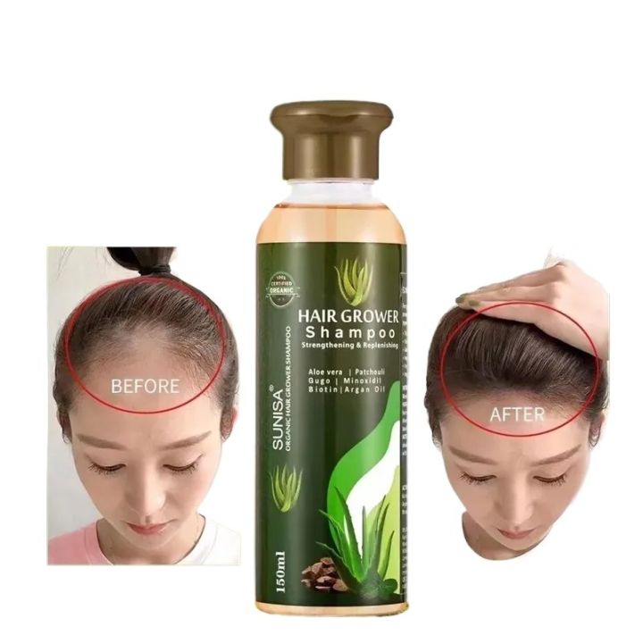SUNISA Hair Grower Prestige Organic Extreme Aloe Vera Hair Grower Shampoo QB/T2872 150 ml