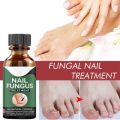 Fast Nail Fungal Treatments Nail Repair Essences Serum Care Treatments Foot Nail Fungus Removal Gel Paronychia Onychomycosis. 