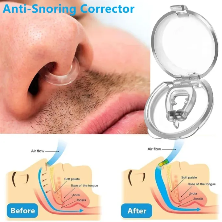Snoring%20Solution,%20Magnetic%20Anti%20Snore%20Clip,%20Magnetic%20Nose%20Clip,%20Snore%20Stopper%20Silicone%20Nose%20Device,%20Comfortable%20&%20Professional%20Anti%20Snoring%20Devices%20for%20Peaceful%20Night%20-%20Image%203